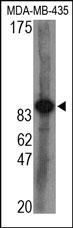 AGO2 / EIF2C2 Antibody - The Slicer Antibody is used in Western blot to detect Slicer in MDA-MB-435 cell lysate.