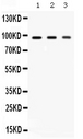 AGO2 / EIF2C2 Antibody - Western blot - Anti-Ago2/eIF2C2 Picoband Antibody