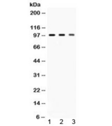 AGO2 / EIF2C2 Antibody - Western blot testing of 1) rat brain, 2) mouse brain and 3) HeLa lysate with AGO2 antibody at 0.5ug/ml. Expected molecular weight ~97 kDa.