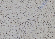 AGO2 / EIF2C2 Antibody - 1:100 staining rat liver tissue by IHC-P. The sample was formaldehyde fixed and a heat mediated antigen retrieval step in citrate buffer was performed. The sample was then blocked and incubated with the antibody for 1.5 hours at 22°C. An HRP conjugated goat anti-rabbit antibody was used as the secondary.