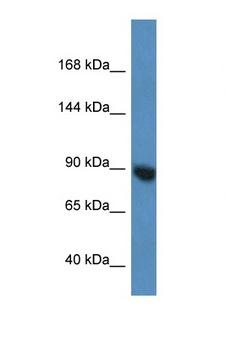 AGO3 / EIF2C3 Antibody - EIF2C3 / AGO3 antibody Western blot of Mouse Pancreas lysate. Antibody concentration 1 ug/ml.  This image was taken for the unconjugated form of this product. Other forms have not been tested.