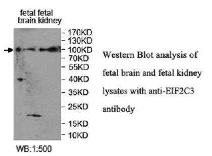 AGO3 / EIF2C3 Antibody - Western blot of AGO3 / EIF2C3 antibody