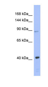 AGO3 / EIF2C3 Antibody - EIF2C3 / AGO3 antibody Western blot of Fetal Thymus lysate. This image was taken for the unconjugated form of this product. Other forms have not been tested.