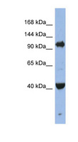 AGO4 / EIF2C4 Antibody - EIF2C4 antibody Western blot of Jurkat lysate. This image was taken for the unconjugated form of this product. Other forms have not been tested.
