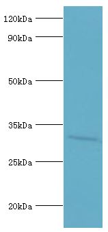 AGPAT1 Antibody - Western blot. All lanes: 1-acyl-sn-glycerol-3-phosphate acyltransferase alpha antibody at 6 ug/ml+K562 whole cell lysate. Secondary antibody: Goat polyclonal to rabbit at 1:10000 dilution. Predicted band size: 32 kDa. Observed band size: 32 kDa Immunohistochemistry.