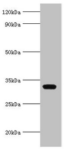 AGPAT1 Antibody - Western blot All lanes: AGPAT1 antibody at 6µg/ml + K562 whole cell lysate Secondary Goat polyclonal to rabbit IgG at 1/10000 dilution Predicted band size: 32 kDa Observed band size: 32 kDa