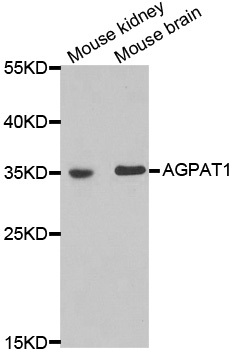AGPAT1 Antibody - Western blot analysis of extracts of various cell lines.