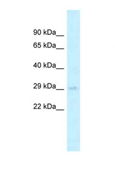 AGPAT2 Antibody - AGPAT2 antibody western blot of 721_B Cell lysate. Antibody concentration 1 ug/ml.  This image was taken for the unconjugated form of this product. Other forms have not been tested.