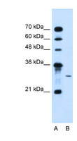 AGPAT2 Antibody - AGPAT2 antibody ARP44637_T100-NP_001012745-AGPAT2(1-acylglycerol-3-phosphate O-acyltransferase 2 ) Antibody Western blot of Jurkat lysate.  This image was taken for the unconjugated form of this product. Other forms have not been tested.