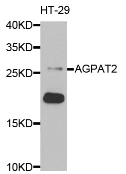 AGPAT2 Antibody - Western blot analysis of extracts of HT-29 cells.