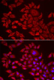 AGPAT2 Antibody - Immunofluorescence analysis of HeLa cells.