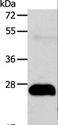 AGPAT2 Antibody - Western blot analysis of Human fetal liver cancer tissue, using AGPAT2 Polyclonal Antibody at dilution of 1:400.