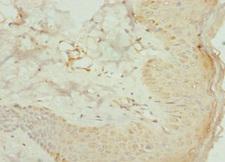 AGPAT2 Antibody - Immunohistochemistry of paraffin-embedded human skin tissue at dilution 1:100