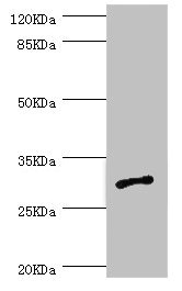 AGPAT2 Antibody - Western blot All Lanes:AGPAT2 antibody at 1.09ug/ml+Jurkat whole cell lysate Secondary Goat polyclonal to rabbit at 1/10000 dilution Predicted band size: 31,28 kDa Observed band size: 31 kDa