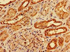 AGPAT3 Antibody - Immunohistochemistry image of paraffin-embedded human kidney tissue at a dilution of 1:100