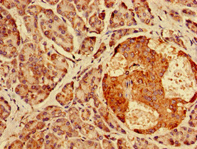AGPAT3 Antibody - Immunohistochemistry image of paraffin-embedded human pancreatic tissue at a dilution of 1:100