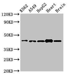AGPAT3 Antibody - Positive Western Blot detected in K562 whole cell lysate, A549 whole cell lysate, HepG2 whole cell lysate, Mouse heart tissue, Mouse brain tissue. All lanes: AGPAT3 antibody at 3 µg/ml Secondary Goat polyclonal to rabbit IgG at 1/50000 dilution. Predicted band size: 44, 37, 46 KDa. Observed band size: 44 KDa