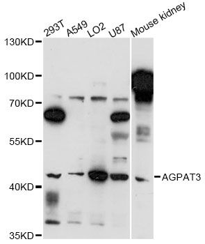 AGPAT3 Antibody - Western blot analysis of extracts of various cell lines, using AGPAT3 antibody at 1:3000 dilution. The secondary antibody used was an HRP Goat Anti-Rabbit IgG (H+L) at 1:10000 dilution. Lysates were loaded 25ug per lane and 3% nonfat dry milk in TBST was used for blocking. An ECL Kit was used for detection and the exposure time was 90s.