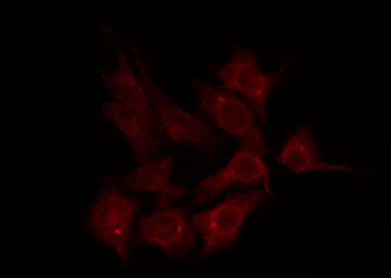 AGPAT3 Antibody - Staining K562 cells by IF/ICC. The samples were fixed with PFA and permeabilized in 0.1% Triton X-100, then blocked in 10% serum for 45 min at 25°C. The primary antibody was diluted at 1:200 and incubated with the sample for 1 hour at 37°C. An Alexa Fluor 594 conjugated goat anti-rabbit IgG (H+L) Ab, diluted at 1/600, was used as the secondary antibody.