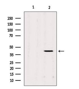 AGPAT3 Antibody - Western blot analysis of extracts of mouse carcinoma using AGPAT3 antibody. Lane 1 was treated with the blocking peptide.