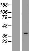 AGPAT3 Protein - Western validation with an anti-DDK antibody * L: Control HEK293 lysate R: Over-expression lysate