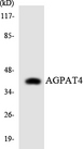 AGPAT4 Antibody - Western blot analysis of the lysates from HeLa cells using AGPAT4 antibody.