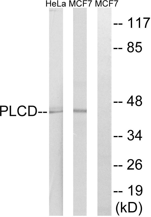 AGPAT4 Antibody - Western blot analysis of lysates from HeLa and MCF-7 cells, using AGPAT4 Antibody. The lane on the right is blocked with the synthesized peptide.