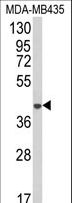 AGPAT4 Antibody - Western blot of AGPAT4 Antibody in MDA-MB435 cell line lysates (35 ug/lane). AGPAT4 (arrow) was detected using the purified antibody.