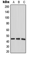 AGPAT4 Antibody - Western blot analysis of LPAAT delta expression in HepG2 (A); MDAMB435 (B); MCF7 (C) whole cell lysates.