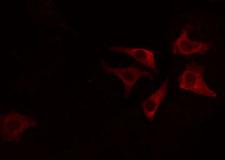 AGPAT4 Antibody - Staining HeLa cells by IF/ICC. The samples were fixed with PFA and permeabilized in 0.1% Triton X-100, then blocked in 10% serum for 45 min at 25°C. The primary antibody was diluted at 1:200 and incubated with the sample for 1 hour at 37°C. An Alexa Fluor 594 conjugated goat anti-rabbit IgG (H+L) antibody, diluted at 1/600, was used as secondary antibody.
