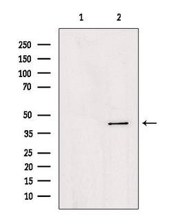 AGPAT4 Antibody - Western blot analysis of extracts of HepG2 cells using AGPAT4 antibody. Lane 1 was treated with the blocking peptide.