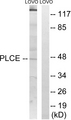 AGPAT5 Antibody - Western blot analysis of lysates from LOVO cells, using AGPAT5 Antibody. The lane on the right is blocked with the synthesized peptide.