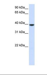 AGPAT5 Antibody - Fetal muscle lysate. Antibody concentration: 1.0 ug/ml. Gel concentration: 12%.  This image was taken for the unconjugated form of this product. Other forms have not been tested.
