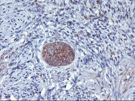 AGPAT5 Antibody - IHC of paraffin-embedded Human endometrium tissue using anti-AGPAT5 mouse monoclonal antibody.