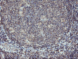 AGPAT5 Antibody - IHC of paraffin-embedded Human tonsil using anti-AGPAT5 mouse monoclonal antibody.