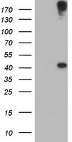 AGPAT5 Antibody - HEK293T cells were transfected with the pCMV6-ENTRY control (Left lane) or pCMV6-ENTRY AGPAT5 (Right lane) cDNA for 48 hrs and lysed. Equivalent amounts of cell lysates (5 ug per lane) were separated by SDS-PAGE and immunoblotted with anti-AGPAT5.