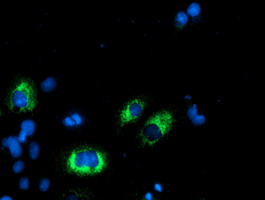 AGPAT5 Antibody - Anti-AGPAT5 mouse monoclonal antibody immunofluorescent staining of COS7 cells transiently transfected by pCMV6-ENTRY AGPAT5.