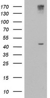 AGPAT5 Antibody - HEK293T cells were transfected with the pCMV6-ENTRY control (Left lane) or pCMV6-ENTRY AGPAT5 (Right lane) cDNA for 48 hrs and lysed. Equivalent amounts of cell lysates (5 ug per lane) were separated by SDS-PAGE and immunoblotted with anti-AGPAT5.