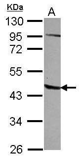 AGPAT5 Antibody - Sample (30 ug of whole cell lysate) A: A549 10% SDS PAGE AGPAT5 antibody diluted at 1:500