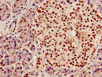 AGPAT5 Antibody - Immunohistochemistry image of paraffin-embedded human pancreatic tissue at a dilution of 1:100