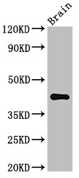 AGPAT5 Antibody - Positive Western Blot detected in Mouse brain tissue. All lanes: AGPAT5 antibody at 3.4 µg/ml Secondary Goat polyclonal to rabbit IgG at 1/50000 dilution. Predicted band size: 43 KDa. Observed band size: 43 KDa