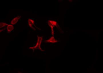 AGPAT5 Antibody - Staining LOVO cells by IF/ICC. The samples were fixed with PFA and permeabilized in 0.1% Triton X-100, then blocked in 10% serum for 45 min at 25°C. The primary antibody was diluted at 1:200 and incubated with the sample for 1 hour at 37°C. An Alexa Fluor 594 conjugated goat anti-rabbit IgG (H+L) Ab, diluted at 1/600, was used as the secondary antibody.