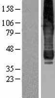 AGPAT6 Protein - Western validation with an anti-DDK antibody * L: Control HEK293 lysate R: Over-expression lysate
