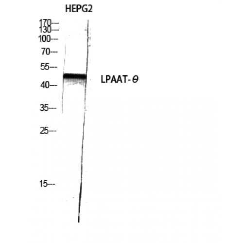 AGPAT9 / MAG1 Antibody - Western blot of LPAAT-theta antibody