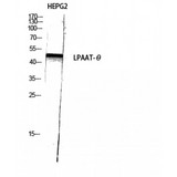 AGPAT9 / MAG1 Antibody - Western blot of LPAAT-theta antibody