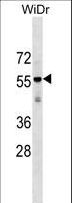 AGPAT9 / MAG1 Antibody - AGPAT9 Antibody western blot of WiDr cell line lysates (35 ug/lane). The AGPAT9 antibody detected the AGPAT9 protein (arrow).