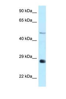 AGPAT9 / MAG1 Antibody - AGPAT9 antibody Western blot of Rat Brain lysate. Antibody concentration 1 ug/ml.  This image was taken for the unconjugated form of this product. Other forms have not been tested.