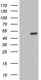 AGPAT9 / MAG1 Antibody - HEK293T cells were transfected with the pCMV6-ENTRY control. (Left lane) or pCMV6-ENTRY AGPAT9. (Right lane) cDNA for 48 hrs and lysed. Equivalent amounts of cell lysates. (5 ug per lane) were separated by SDS-PAGE and immunoblotted with anti-AGPAT9. (1:500)