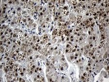 AGPAT9 / MAG1 Antibody - Immunohistochemical staining of paraffin-embedded Human liver tissue within the normal limits using anti-AGPAT9 mouse monoclonal antibody. (Heat-induced epitope retrieval by 1mM EDTA in 10mM Tris buffer. (pH8.5) at 120°C for 3 min. (1:500)