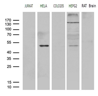 AGPAT9 / MAG1 Antibody - Western blot analysis of extracts. (35ug) from 4 different cell lines and rat brain tissue lysate by using anti-AGPAT9 monoclonal antibody. (1:500)